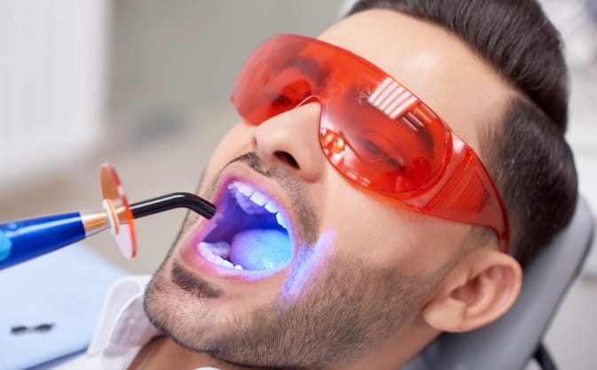 a man sitting in a dental chair with his mouth open. a curing light used for composite fillings is shining in his mouth