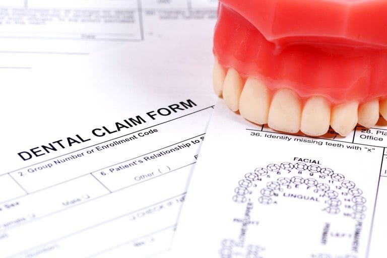dental forms on a table next to a dental model of an upper arch with teeth