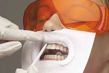 a person getting prepared for zoom teeth whitening