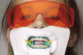a person who is prepared and ready for Zoom teeth whitening